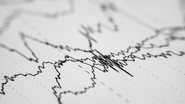 exame de ondas cerebrais - Adobe Stock