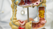 A obstrução intestinal é uma condição médica séria que impede a passagem pelo intestino - Foto: Envato Elements/chormail