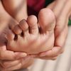 O engrossamento da pele é uma reação natural do corpo para proteger a área - Envato Elements