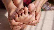 O engrossamento da pele é uma reação natural do corpo para proteger a área - Envato Elements