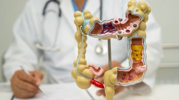 Exame ajuda a prevenir o câncer colorretal, um dos mais frequentes do Brasil, segundo o Inca - Envato Elements