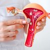 Quanto mais cedo a endometriose for identificada, maiores as chances de um tratamento eficaz - Foto: Envato Elements