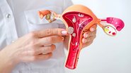 Quanto mais cedo a endometriose for identificada, maiores as chances de um tratamento eficaz - Foto: Envato Elements