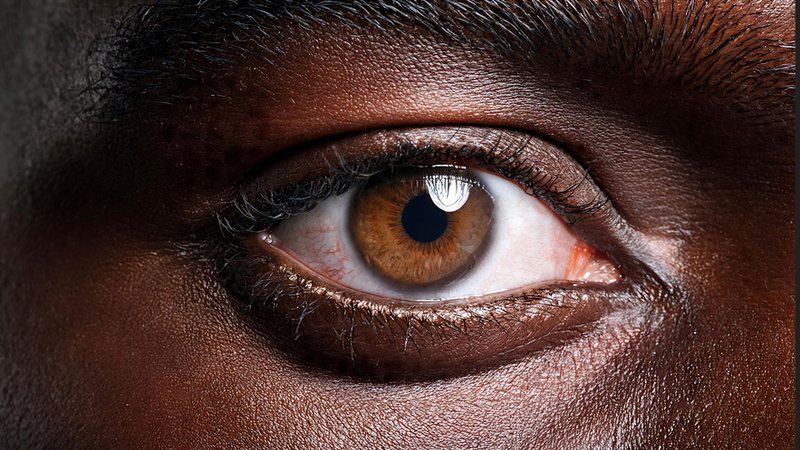 Reação adversa considerada “muito rara”, a neuropatia óptica isquêmica anterior não arterítica  pode ser irreversível - Envato