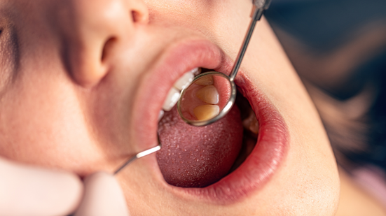 A dor pode ser sinal de cárie profunda, infecção ou até abscesso - Foto: Envato Elements