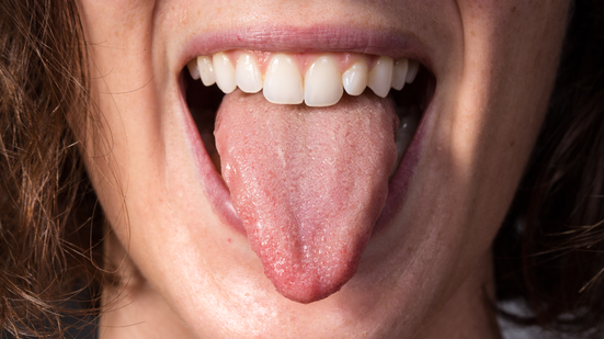 A cor da língua é um dos sinais mais perceptíveis e pode fornecer pistas importantes sobre a saúde - Foto: Envato Elements