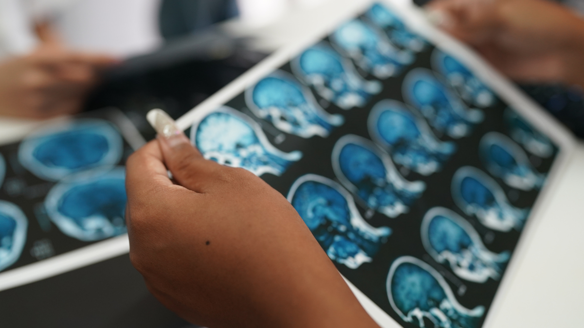 Uso de terapia hormonal para aliviar os sintomas da menopausa e climatério gera debate - Foto: Envato Elements