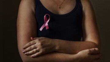 SUS vai adotar teste genético preventivo para detectar câncer de mama