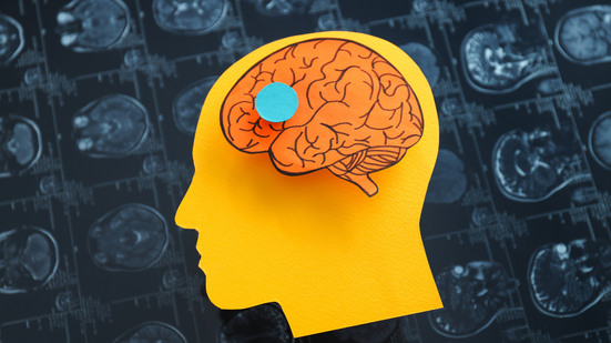 Desafios cognitivos ajudam a afastar o risco de demência, dizem especialistas; 60% dos casos poderiam ser evitados - Foto: Envato Elements