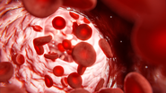 A anemia é um problema de saúde pública que atinge milhões de pessoas no Brasil e no mundo - Foto: Envato Elements