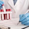 Marcadores como Gama GT, ácido úrico e homocisteína, mesmo discretamente alterados, podem sinalizar riscos cardiovasculares e metabólicos - Divulgação