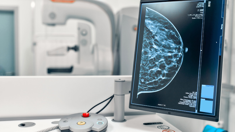 No Brasil, o câncer de mama é o tipo de tumor mais comum entre as mulheres e representa a principal causa de morte por câncer nessa população - Envato