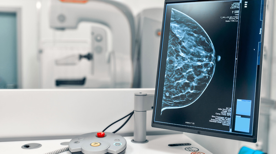 No Brasil, o câncer de mama é o tipo de tumor mais comum entre as mulheres e representa a principal causa de morte por câncer nessa população - Envato