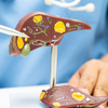 Além do aumento do tamanho e da coloração amarelada do órgão, em estágios mais avançados o transplante pode se tornar a única alternativa - Foto: Envato Elements