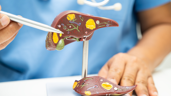 Além do aumento do tamanho e da coloração amarelada do órgão, em estágios mais avançados o transplante pode se tornar a única alternativa - Foto: Envato Elements