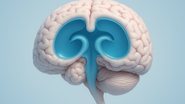 Hidrocefalia de pressão normal costuma ser confundida com demência - Adobe Stock