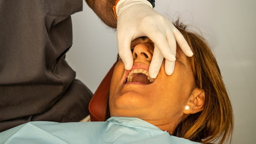 O hábito exerce uma sobrecarga nas arcadas dentárias e nos músculos da face - Foto: Envato Elements