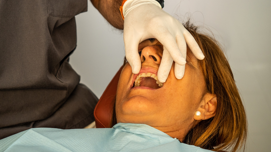 O hábito exerce uma sobrecarga nas arcadas dentárias e nos músculos da face - Foto: Envato Elements