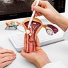 Não existe exame que detecta precocemente o câncer de ovário, o que eleva os riscos da doença, especialmente na fase da menopausa - Envato Elements