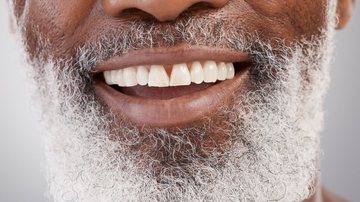 Segundo dentistas,  com uso de quatro a seis pinos de titânio é possível reconstruir uma arcada completa, proporcionando uma aparência normal - Foto: Envato Elements