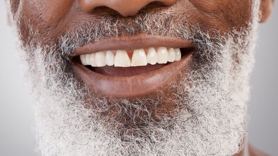 Segundo dentistas,  com uso de quatro a seis pinos de titânio é possível reconstruir uma arcada completa, proporcionando uma aparência normal - Foto: Envato Elements