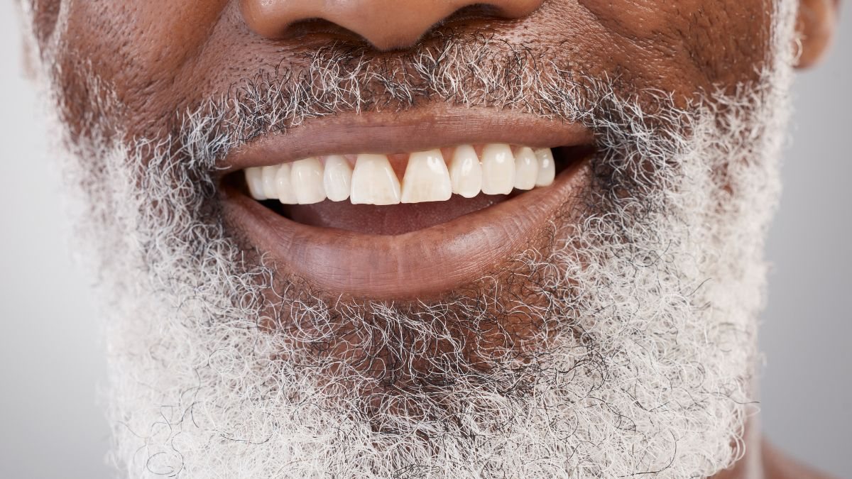 Segundo dentistas,  com uso de quatro a seis pinos de titânio é possível reconstruir uma arcada completa, proporcionando uma aparência normal - Foto: Envato Elements