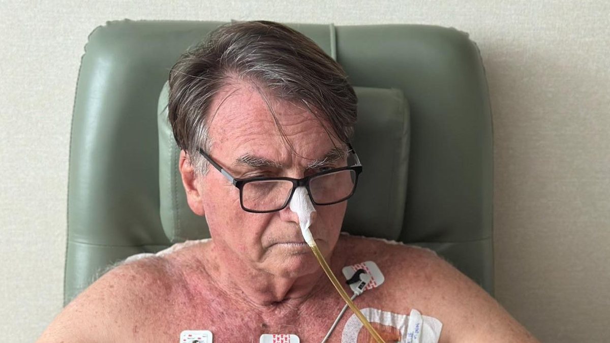 Médicos  afirmam que apesar da alta,  Bolsonaro requer cuidados porque tem apneia do sono e precisa usar uma máscara especial para dormir - Fotos Públicas