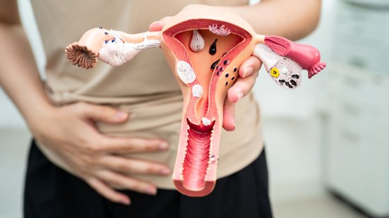 Doença causa cólica intensa, sangramento prolongado e até dificuldade para engravidar, explica especialista - Envato