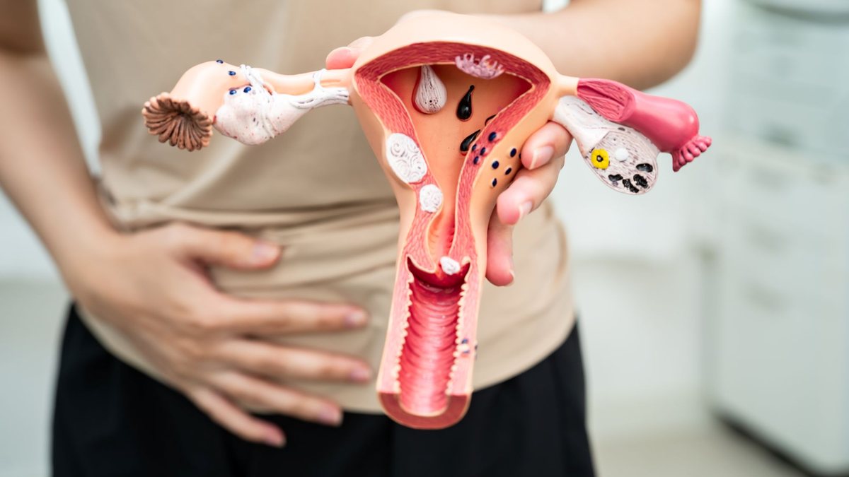 Doença causa cólica intensa, sangramento prolongado e até dificuldade para engravidar, explica especialista - Envato