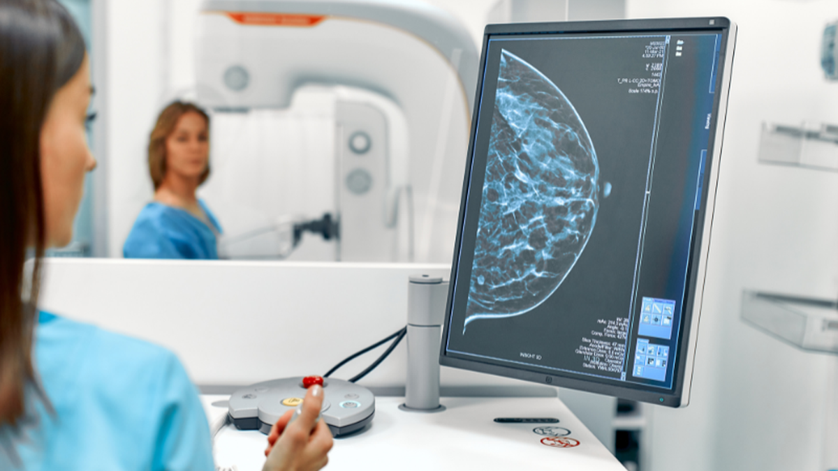 Relatora do projeto destacou a importância da antecipação da idade para o rastreamento da doença - Adobe Stock