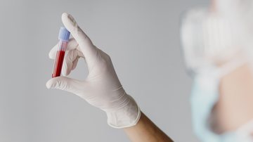 Médicos analisam o resultado junto com outros exames e com o histórico de saúde da pessoa - Foto: Freepik