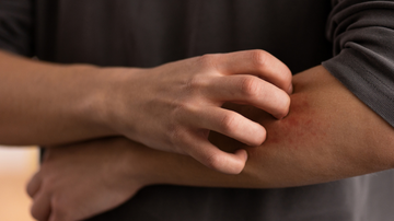 Transmissão ocorre pelas vias aéreas superiores, através da tosse, espirro ou fala de uma pessoa doente, sem tratamento, para outra - Freepik