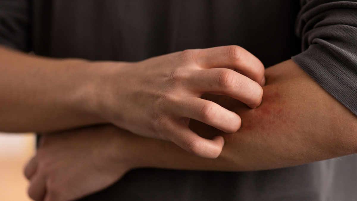 Transmissão ocorre pelas vias aéreas superiores, através da tosse, espirro ou fala de uma pessoa doente, sem tratamento, para outra - Freepik