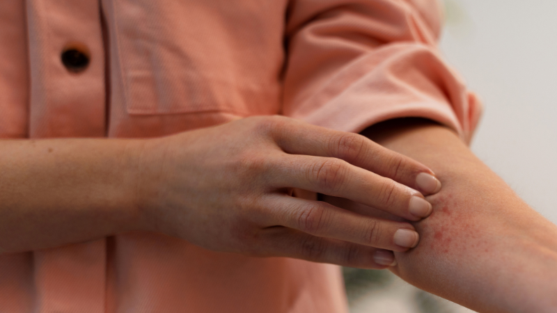 O principal motivo para a rejeição da vacina para o SUS foi o impacto financeiro elevado em comparação ao benefício que o imunizante traria no momento - Freepik