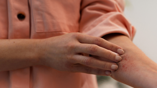 O principal motivo para a rejeição da vacina para o SUS foi o impacto financeiro elevado em comparação ao benefício que o imunizante traria no momento - Freepik