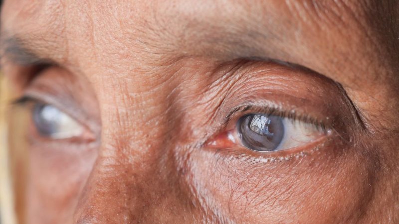 O diagnóstico é feito em consultório oftalmológico - Foto: Envato Elements