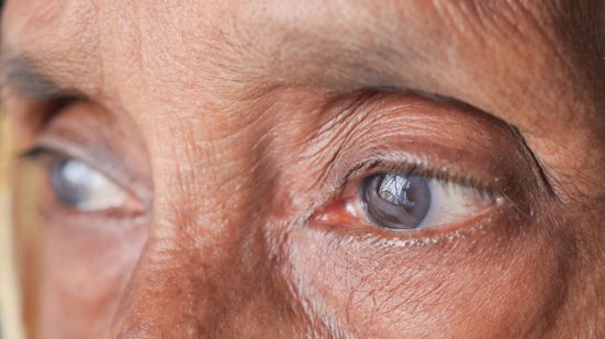 O diagnóstico é feito em consultório oftalmológico - Foto: Envato Elements