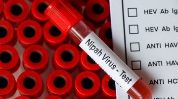 O Nipah pode causar infecções respiratórias agudas e encefalite (inchaço do cérebro) - Adobe Stock