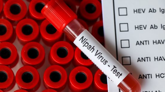 O Nipah pode causar infecções respiratórias agudas e encefalite (inchaço do cérebro) - Adobe Stock