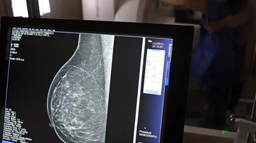 A mamografia digital é considerada um dos principais exames para a detecção precoce do câncer de mama, mas ainda não tem cobertura dos planos de saúde - José Cruz/Agência Brasil