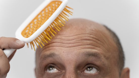 Queda de cabelo pode indicar fatores genéticos ou inflamatórios - Banco de Imagens / Freepik