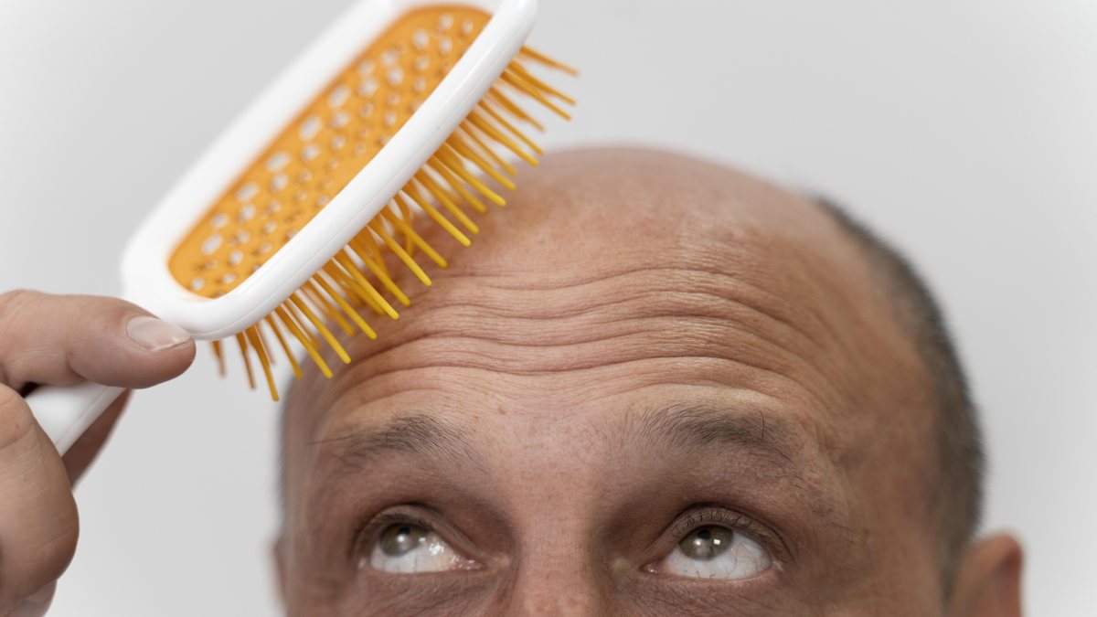 Queda de cabelo pode indicar fatores genéticos ou inflamatórios - Banco de Imagens / Freepik