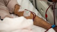 No Brasil, 87,3% dos pacientes realizam hemodiálise, 7,1% hemodiafiltração, e apenas 5,6% fazem diálise peritoneal - AdobeStock