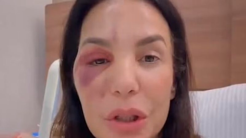 Ivete Sangalo detalhou o diagnóstico que recebeu de síndrome vasovagal - Reprodução/Instagram via @ivetesangalo