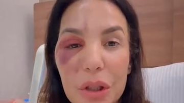 Ivete Sangalo detalhou o diagnóstico que recebeu de síndrome vasovagal - Reprodução/Instagram via @ivetesangalo