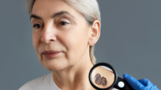 A falta de tais dados compromete diretamente a análise da situação epidemiológica da doença - Freepik