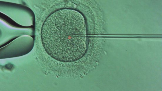 Técnica se mostrou mais segura do que anteriores ao alterar genes relacionados à anemia falciforme e a doenças cardiovasculares - Reprodução/Acervo pessoal
