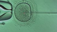 Técnica se mostrou mais segura do que anteriores ao alterar genes relacionados à anemia falciforme e a doenças cardiovasculares - Reprodução/Acervo pessoal