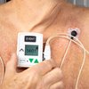 A recomendação é iniciar o acompanhamento cardiológico regular a partir dos 40 anos, mas algumas pessoas precisam iniciar antes; veja quando buscar um médico - AdobeStock
