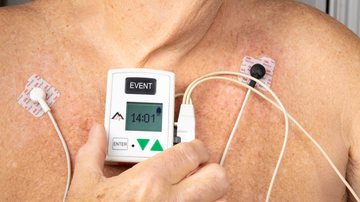 A recomendação é iniciar o acompanhamento cardiológico regular a partir dos 40 anos, mas algumas pessoas precisam iniciar antes; veja quando buscar um médico - AdobeStock